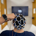 Rehabilitación Neuropsicológica, una solución ante un Daño Cerebral
